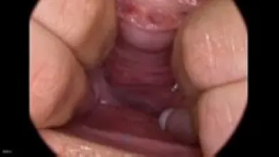 Изучим строение вагины